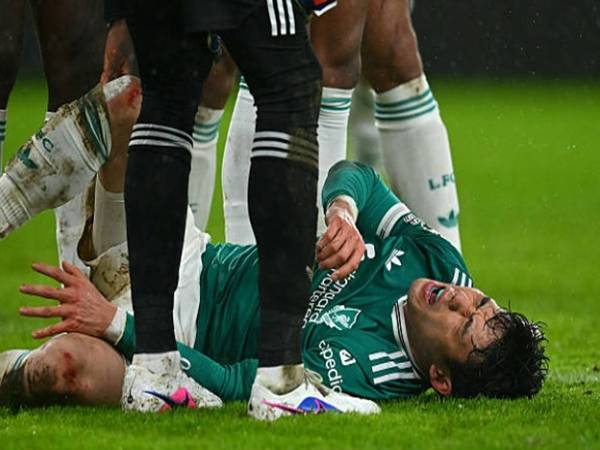 Arne Slot thừa nhận nguy cơ nghỉ dài hạn